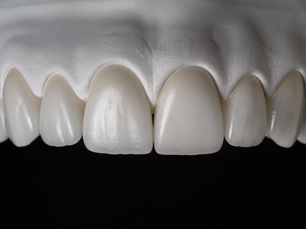 Close-up of moderately clean teeth after using an electronic toothbrush